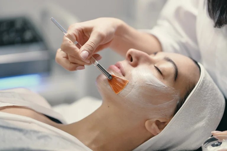 Chemical Peels