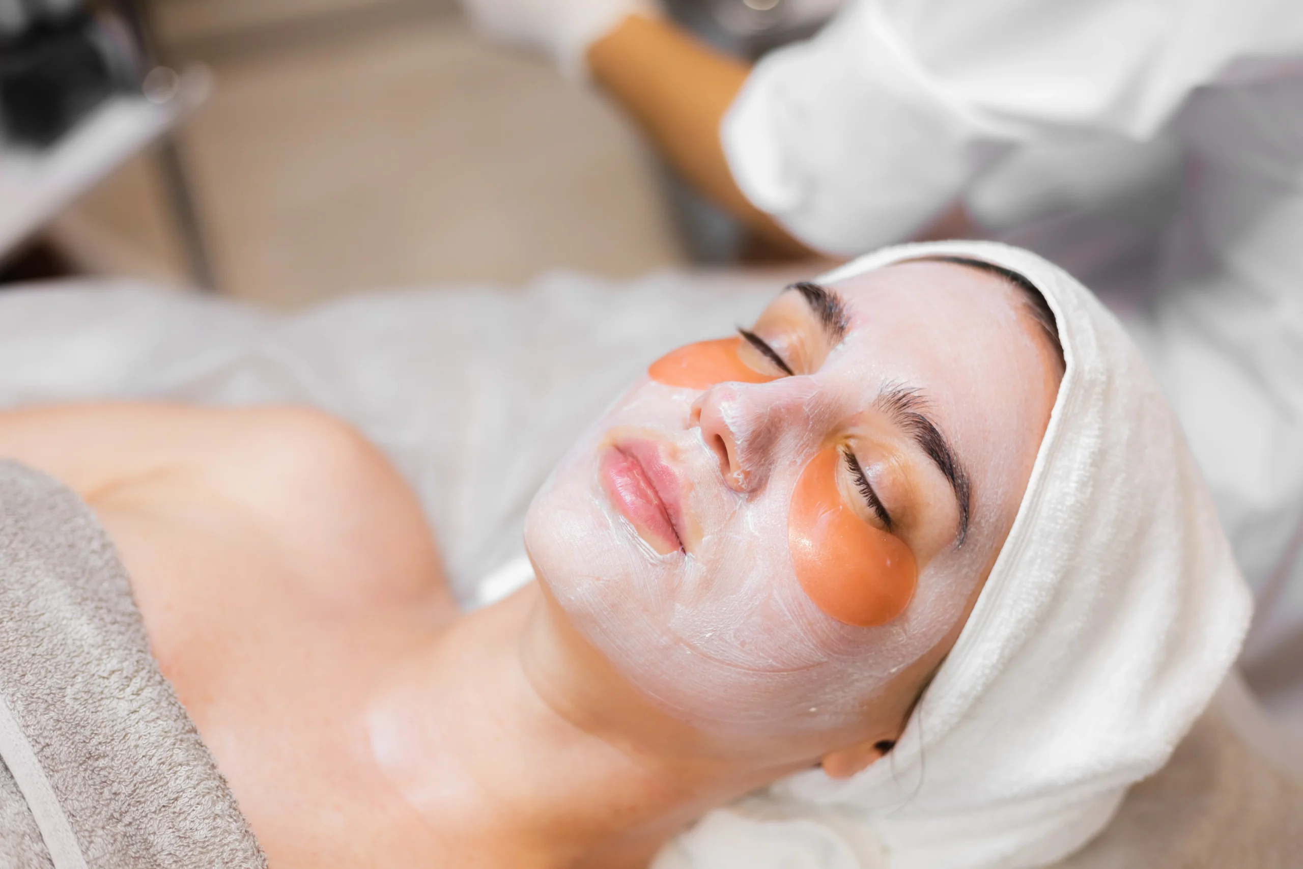 Chemical Peels